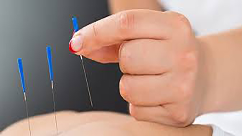 Acupressure & Acupuncture