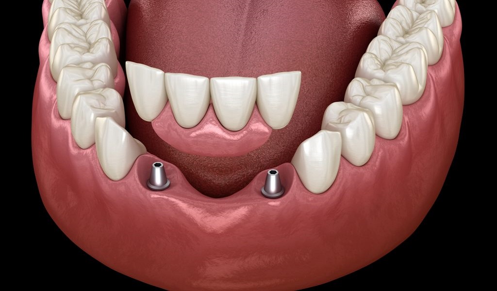 Edge Dental